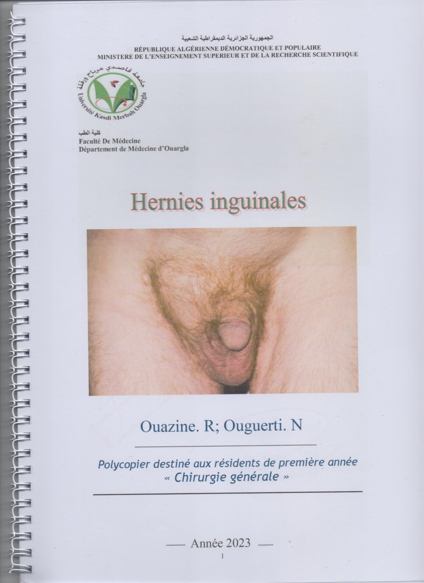 Hernies inguinales 001 1